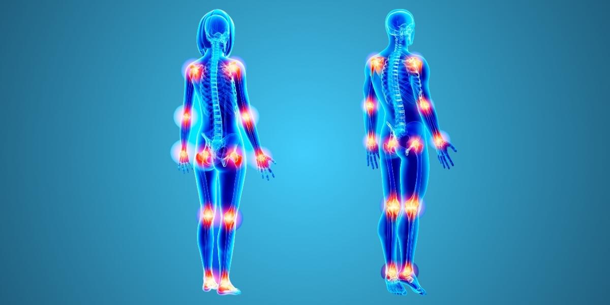 Você está visualizando atualmente Artrite Reumatoide: Aliviando a Dor e Mantendo a Mobilidade